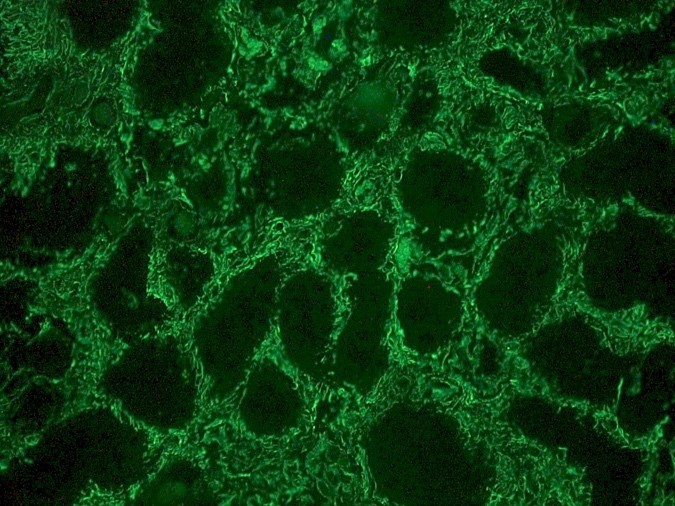Figure 3. Indirect immunofluorescence staining of human kidney tissue section with MUB1903P (diluted 1:1000), showing the specific pattern of vimentin in the mesenchymal cell types, such as fibroblasts in the connective tissue, podocytes, and endothelial cells in blood vessels. As expected, no reactivity is seen in the epithelial cell compartment
